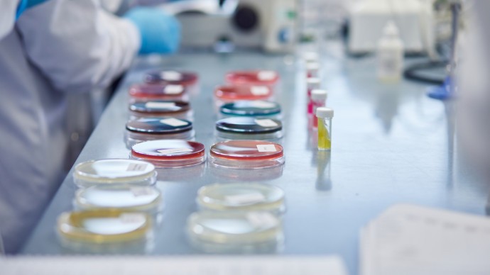 14 brightly coloured Petri dishes on a lab desk